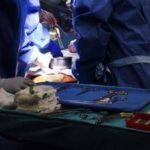 Trapianti, in Italia record donazioni e scende attesa, a Milano congresso specialisti