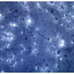 Microplastiche nella prostata e nel liquido seminale, la scoperta italiana: cosa comporta