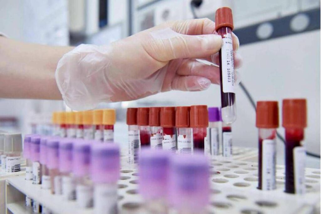 Tumore allo stomaco in stadio precoce, con immunoterapia 69% pazienti vivo a 3 anni