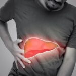 Steatosi epatica per 25% italiani, studio ‘integratore con alghe utile in 50% casi’