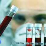 Giornata patologie eosinofile, ematologa Iurlo ‘fino a 5 anni per diagnosi’