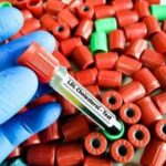 Colesterolo Ldl, per abbassalo in sviluppo nuova terapia con tripla combinazione 