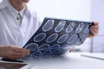 Giornata Sla, neurologi: “Non resti confinata alla sperimentazione”
