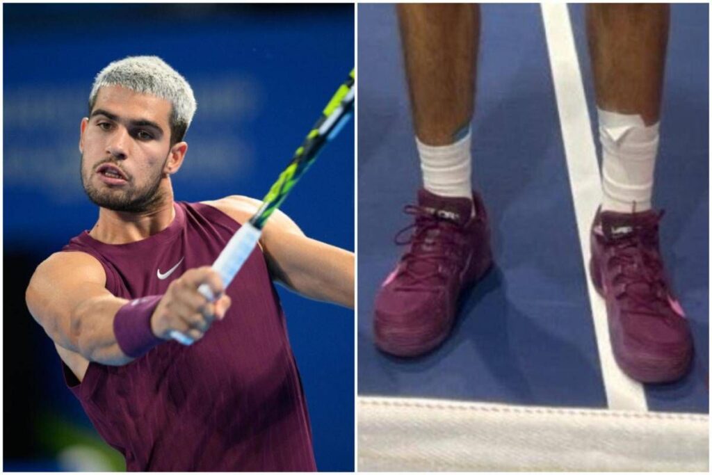 Alcaraz ancora infortunato? La fasciatura ‘sospetta’ al Six Kings Slam