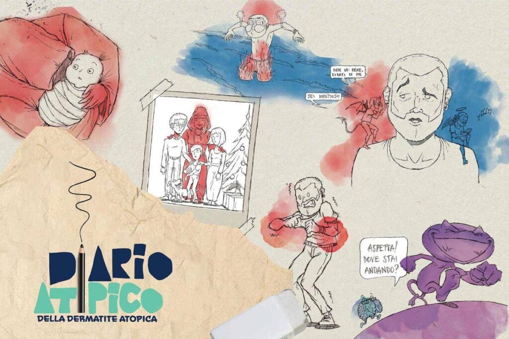 Dermatite atopica, oltre 1,3 mln di persone hanno visto il corto ‘Diario atipico’