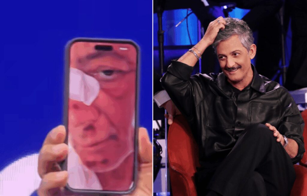 Fiorello, l’incidente in bicicletta: “Volevo fare il figo… sono caduto di faccia”