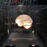 Medicina, neurologi: “L’innovazione può cambiare la storia di molte malattie ma serve equità”