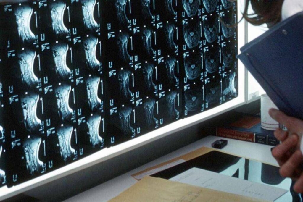 Oltre 500 malattie rare delle ossa, esperti: “Investire in prevenzione e diagnosi”