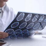 Salute, psicologa Borghi: “Oltre la sclerosi multipla un percorso verso il futuro”