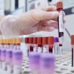 Sclerosi multipla recidivante, Ema raccomanda approvazione ocrelizumab dai 10 anni