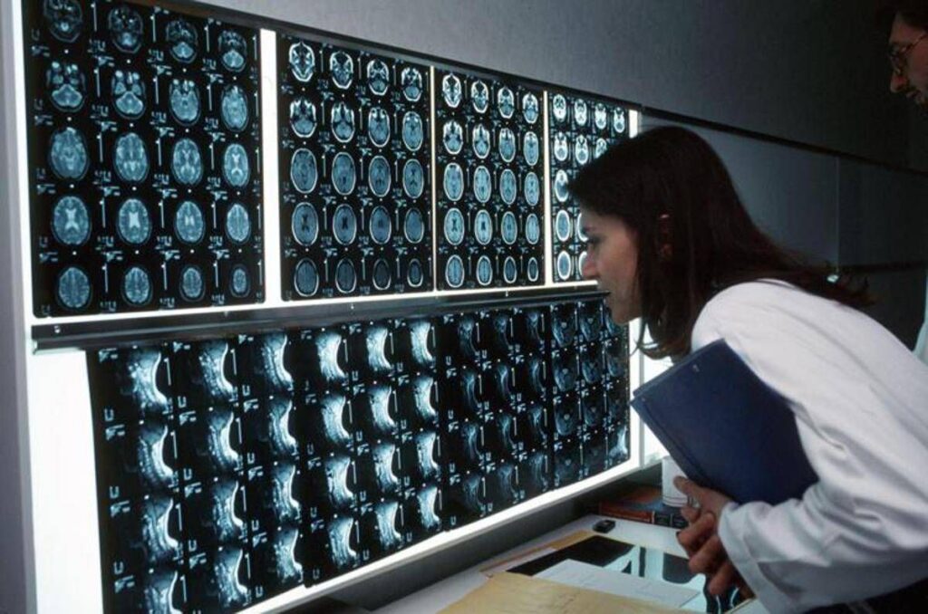 Cancro, 4 sintomi ‘insoliti’ che bisogna conoscere: parola di oncologo