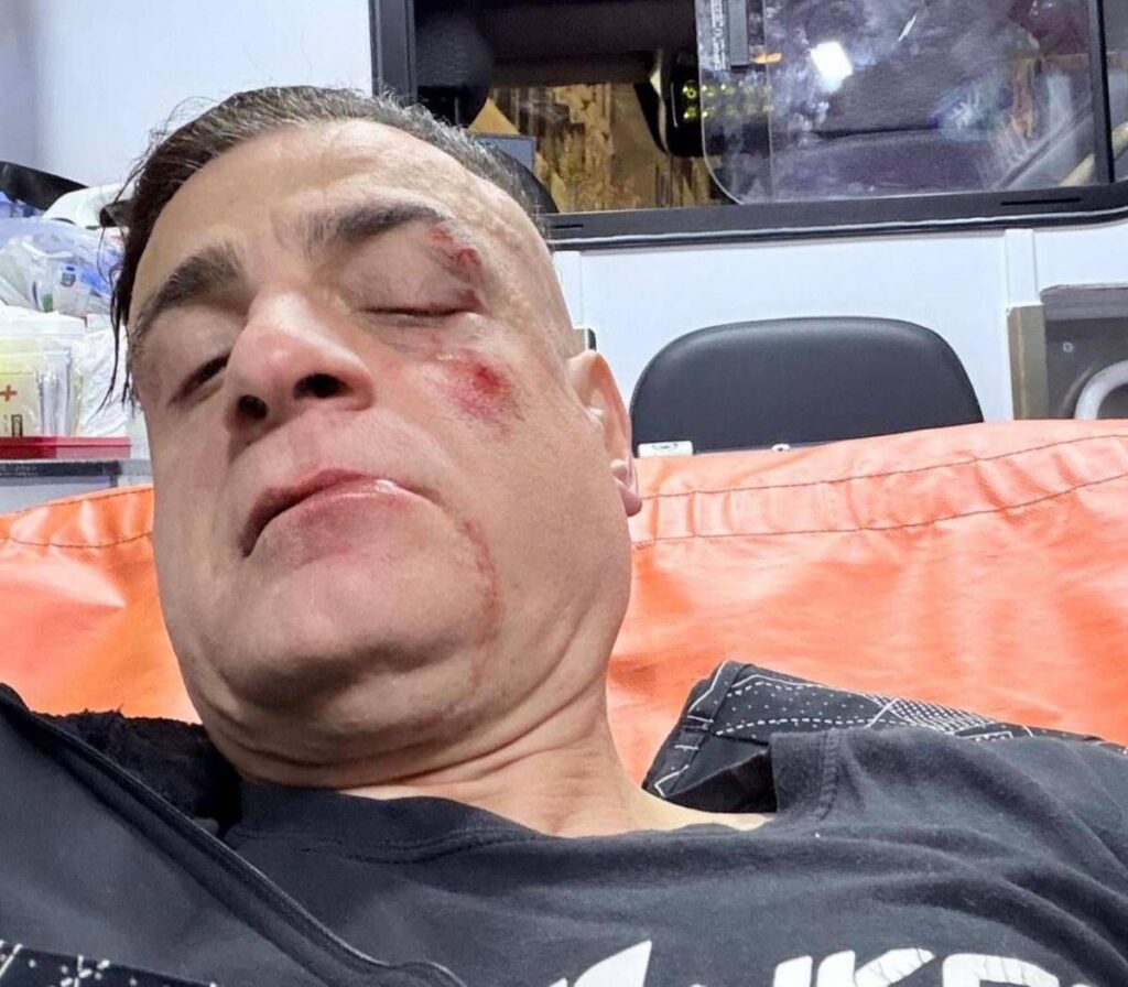 Cicalone, lo youtuber aggredito in metro a Roma: “Infami veri”