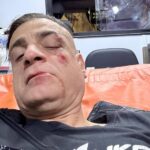 Cicalone, lo youtuber aggredito in metro a Roma: “Infami veri”