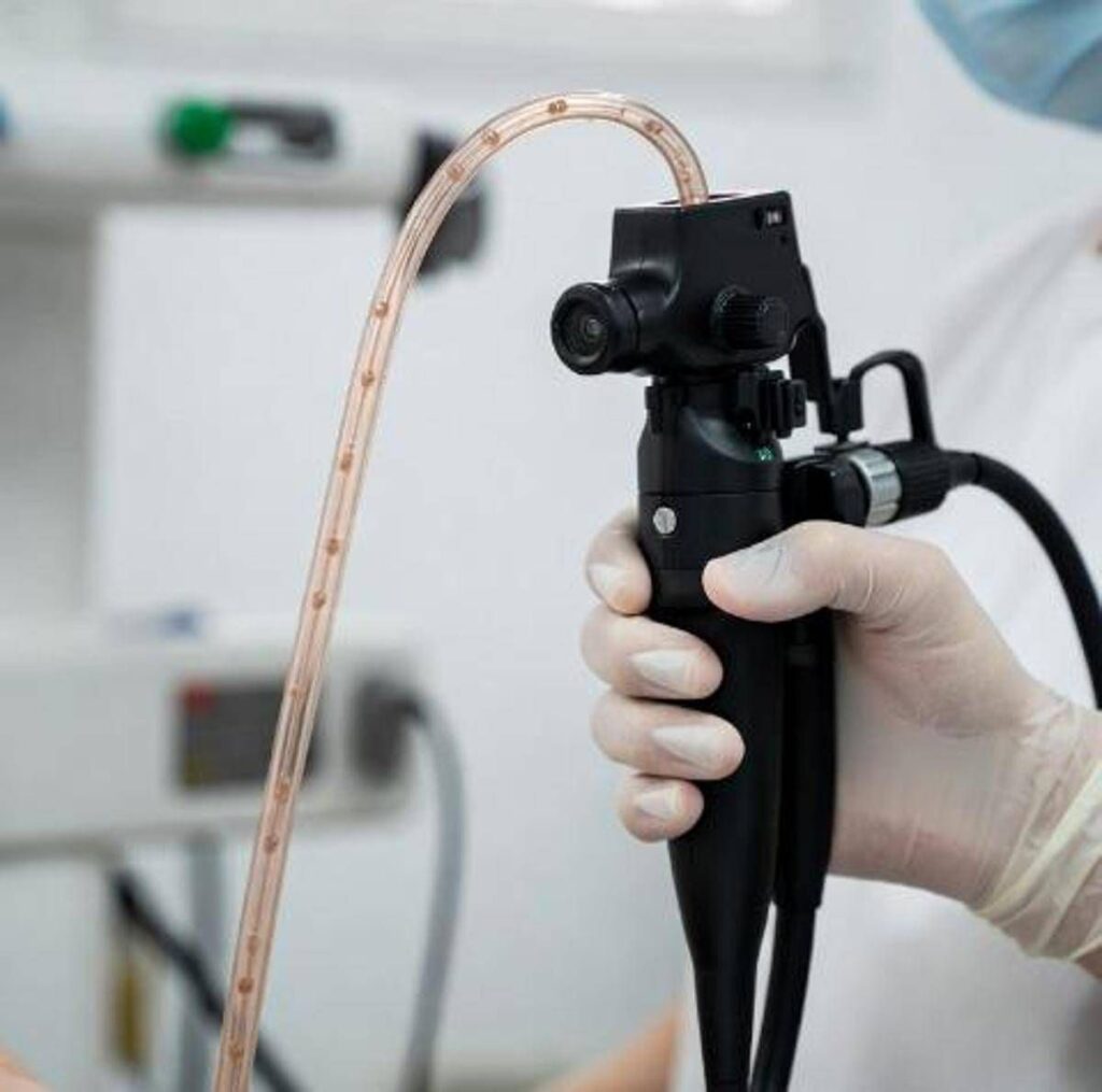 Esofagite eosinofila scambiata per depressione, cos’è e come riconoscerla