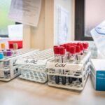 Medicina di laboratorio, ‘un semplice esame per scoprire in anticipo le patologie’