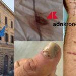 Denunciò botte e sequestro in cella: “Ora vivo nella paura, colpisce il silenzio delle istituzioni”