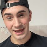 Genova, 19enne denuncia aggressione omofoba: “Sfregiato al viso con coltellino”