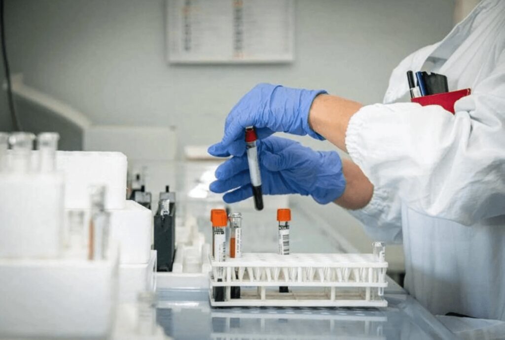 Alzheimer, test del sangue possono prevedere l’inizio dei sintomi