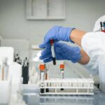 Alzheimer, test del sangue possono prevedere l’inizio dei sintomi