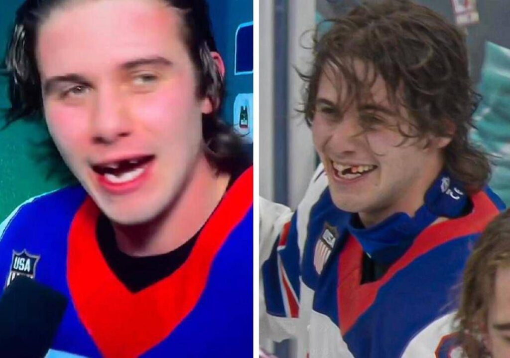 Perde due denti e segna il gol per l’oro, Hughes eroe dell’hockey Usa