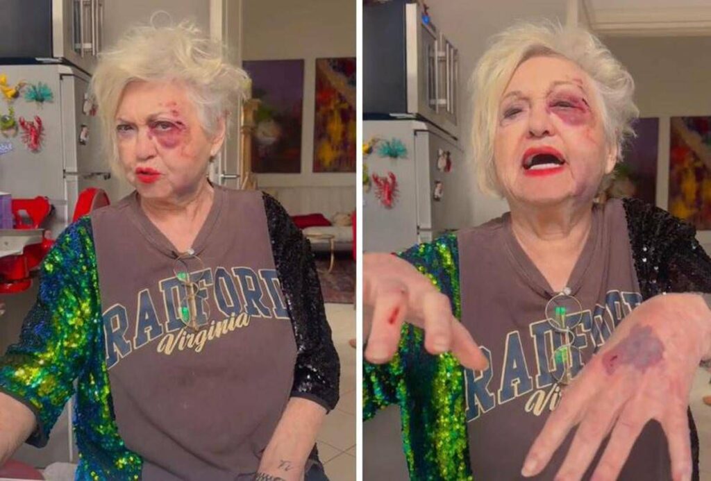 Wanna Marchi investita a Milano: “Sono devastata, ho rischiato la vita”