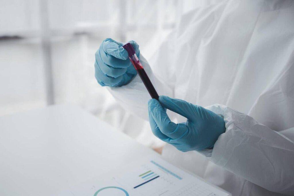 Epatite A in forte crescita in Italia: Lazio, Campania e Puglia le regioni con più casi