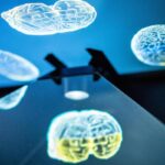 Ictus, ecco come l’emisfero sano del cervello influenza la ripresa: la ricerca rivoluzionaria