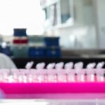 Milano, focolaio di tubercolosi all’Istituto di Medicina legale: 8 casi conclamati e 7 positivi. Indagini sull’origine del contagio