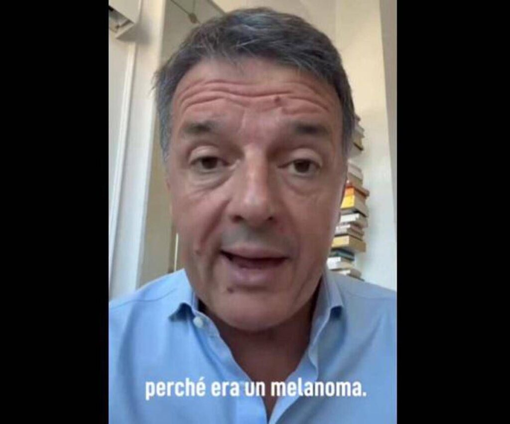 Renzi e il melanoma: “L’ho rimosso, nessun rischio per me ma bisogna controllarsi”