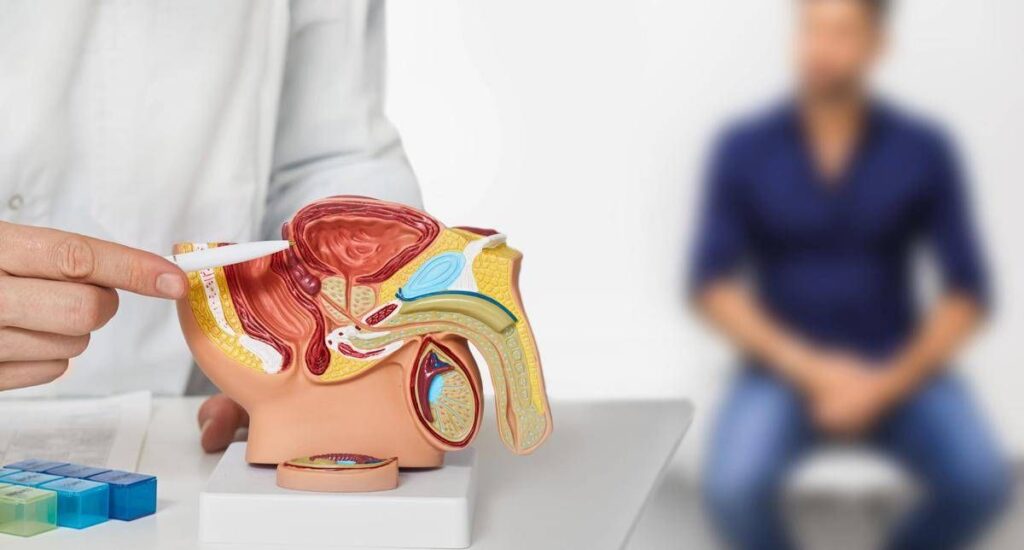 Tumori prostata, Fondazione Aiom: “In 10 anni +55% uomini vivi dopo la diagnosi”