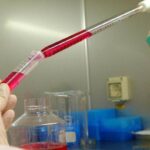 Melanoma uveale metastatico: “Tebentafusp raddoppia sopravvivenza a 5 anni”