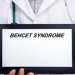 Giornata sindrome Behçet, esperto: “Oggi possiamo prevenire cecità”