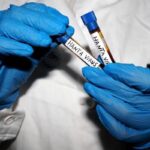 Hantavirus, Ema monitora diffusione: “Pronti a supportare iter vaccini”