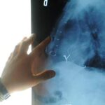 Radiologia interventistica, Ssn e fondazioni per cure più accessibili