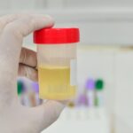Dai segnali del colore alla postura, sui social è ‘urina mania’ tra scienza e falsi miti