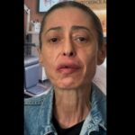 Gerardina Trovato annulla il tour: “Devo operarmi d’urgenza”