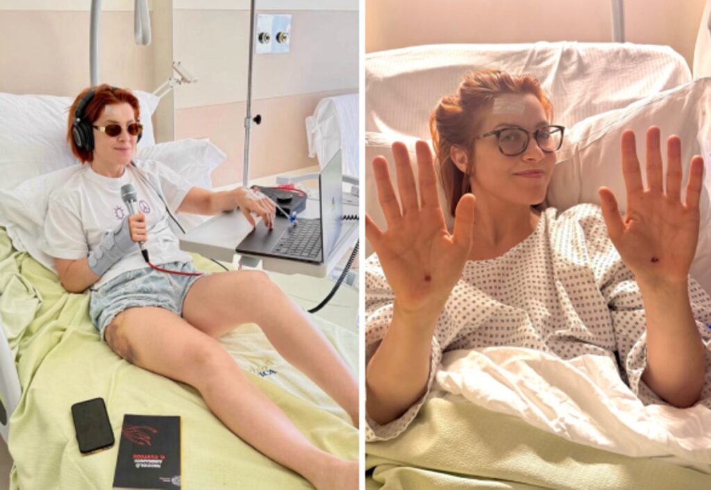 Noemi, la sessione di canto in ospedale e le dimissioni: come sta dopo la caduta dal palco