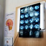 “11 anni di chemio per un tumore che non c’era”, la diagnosi sbagliata e l’incubo