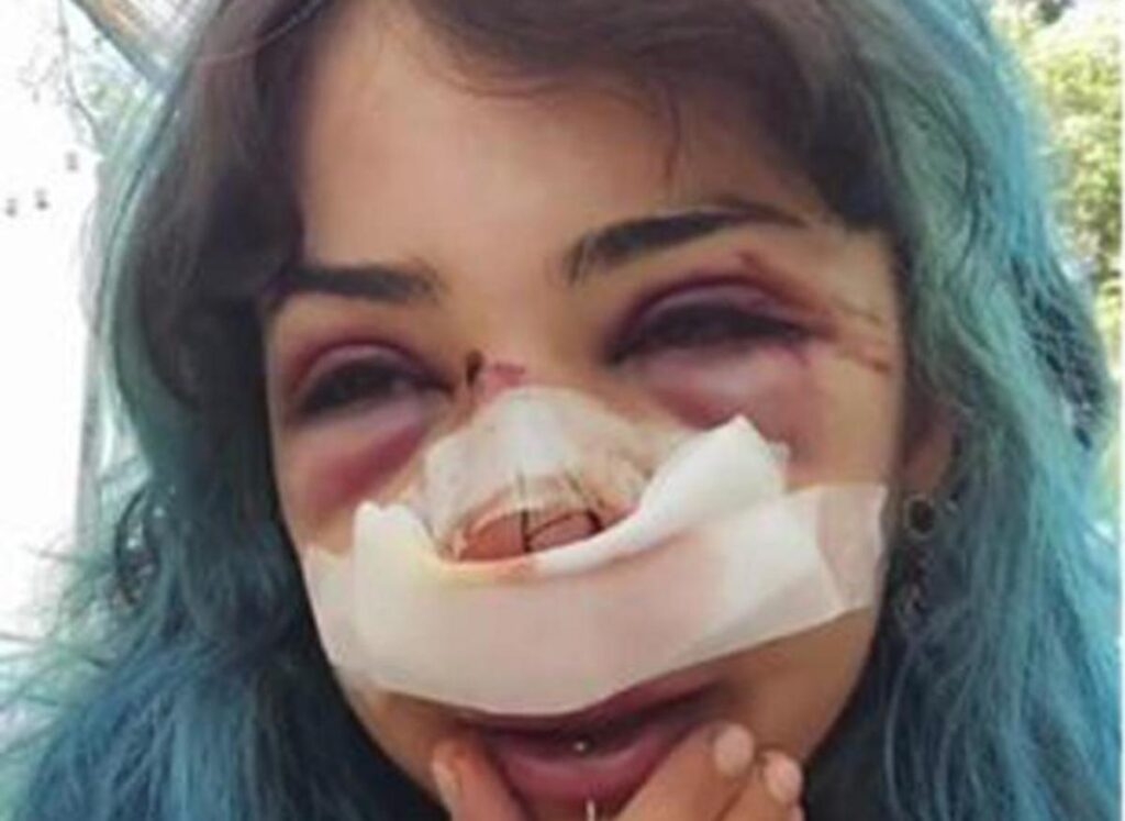 Bari, studentessa picchiata nei bagni denuncia nuovo episodio: “Mi hanno accerchiata”
