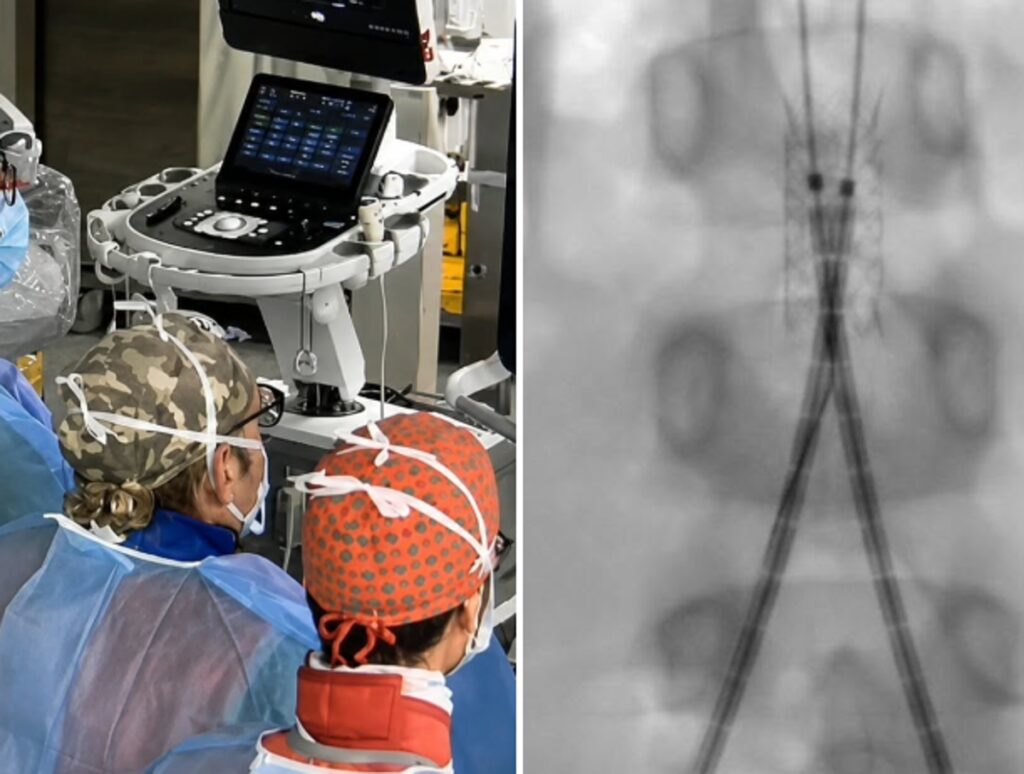 Incidente con un’acquasantiera in chiesa, bimba di 6 anni operata d’urgenza all’aorta a Bari