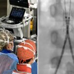 Incidente con un’acquasantiera in chiesa, bimba di 6 anni operata d’urgenza all’aorta a Bari