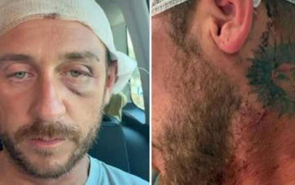 “Io aggredito a sassate in Sardegna da 30 persone perché gay”, la denuncia sui social ﻿