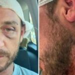 “Io aggredito a sassate in Sardegna da 30 persone perché gay”, la denuncia sui social 