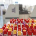 Malaria in aeroporto in Germania, gli esperti: “Campanello d’allarme, ma il rischio resta contenuto”