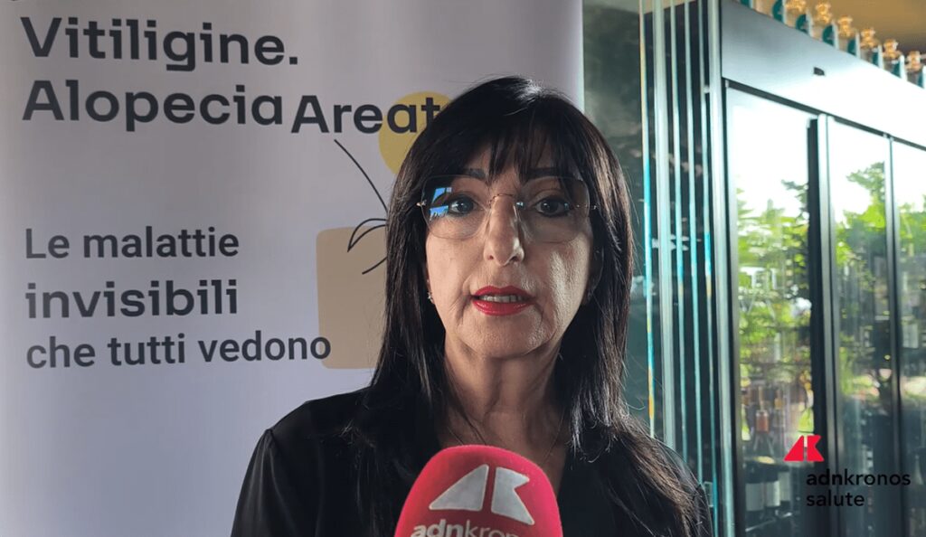 Cassia (Aipaf): “Con nuove terapie Ssn riconosca alopecia per sostenere i pazienti”
