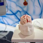 Dai gliomi al Parkinson, così l’intelligenza artificiale aiuta la Neurochirurgia