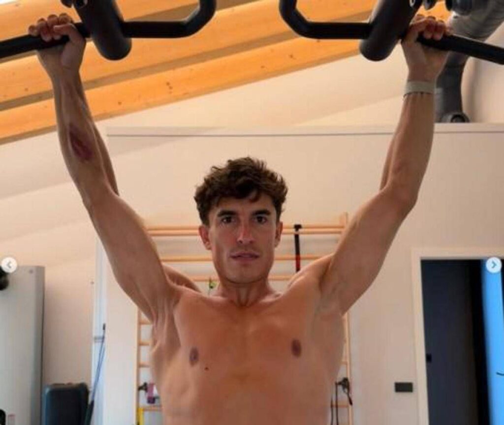 Marquez e la foto choc: il pilota mostra la spalla ‘deformata’