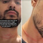 Mr. Daniel, il make-up artist dei vip, aggredito e rapinato a Milano: il racconto choc sui social