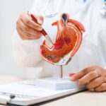 Cancro allo stomaco avanzato, nuova terapia riduce del 42% il rischio di morte ﻿