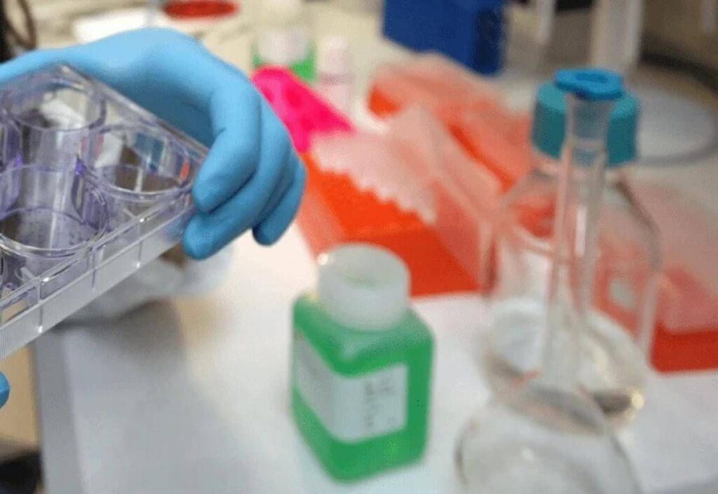Colite ulcerosa, nuovi dati dallo studio Verdict su vedolizumab